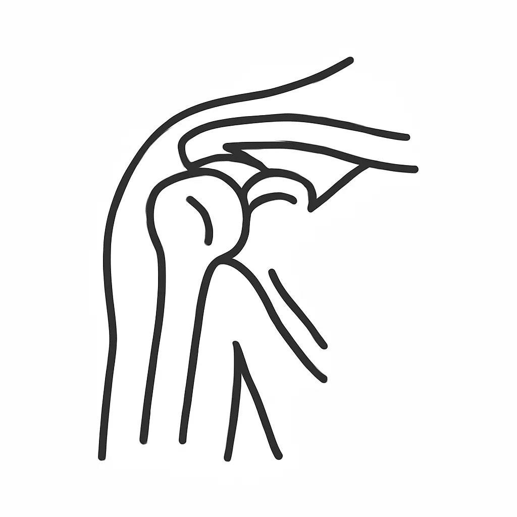 Ilustrace znázorňující téma: Tendinitida rotátorové manžety: Jak se s ní vyrovnat